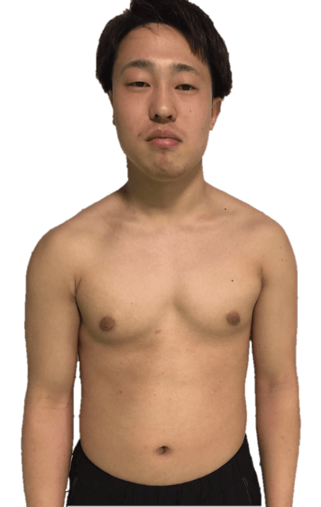 before,体型が崩れた男性